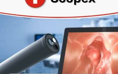 Carlos Santos – Scopex