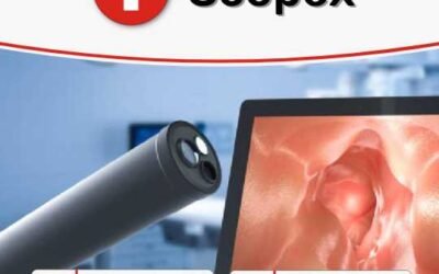 Sérgio Almeida – Scopex