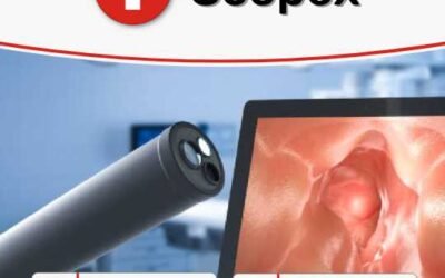 Thaís Carrozzini Benedetti – Scopex